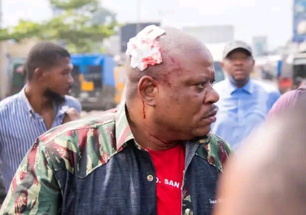 RDC : opposant Jean Marc Kabund blessé lors de sa matinée politique à Camp Luka